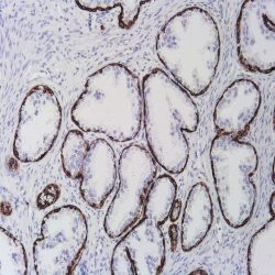 آنتی بادی ALK برند NOVOCELL