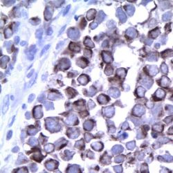 آنتی بادی Cytokeratin 5/6  برند NOVOCELL