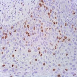 آنتی بادی E-Cadherin  برند NOVOCELL