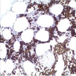 آنتی بادی GATA3  برند NOVOCELL