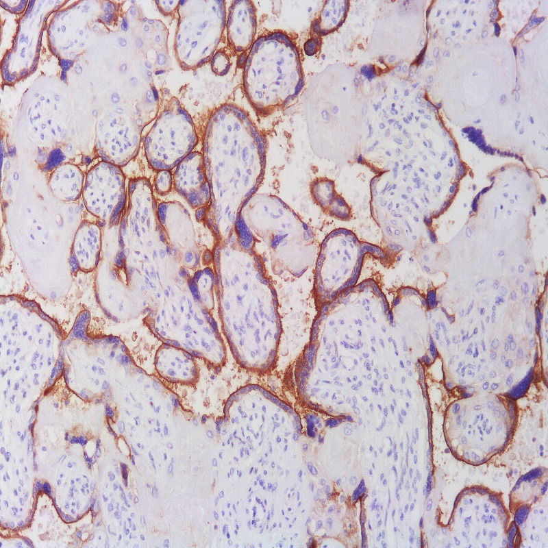 آنتی بادی PDL1 برند NOVOCELL