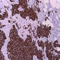 آنتی بادی P16  برند NOVOCELL