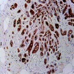 آنتی بادی P53  برند NOVOCELL