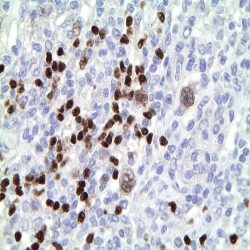 آنتی بادی Synaptophysin  برند NOVOCELL