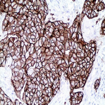 آنتی بادی HER2 برند NOVOCELL