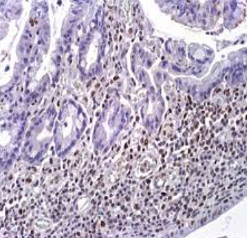 آنتی بادی MLH1 برند NOVOCELL