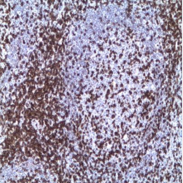 آنتی بادی CD5 برند NOVOCELL