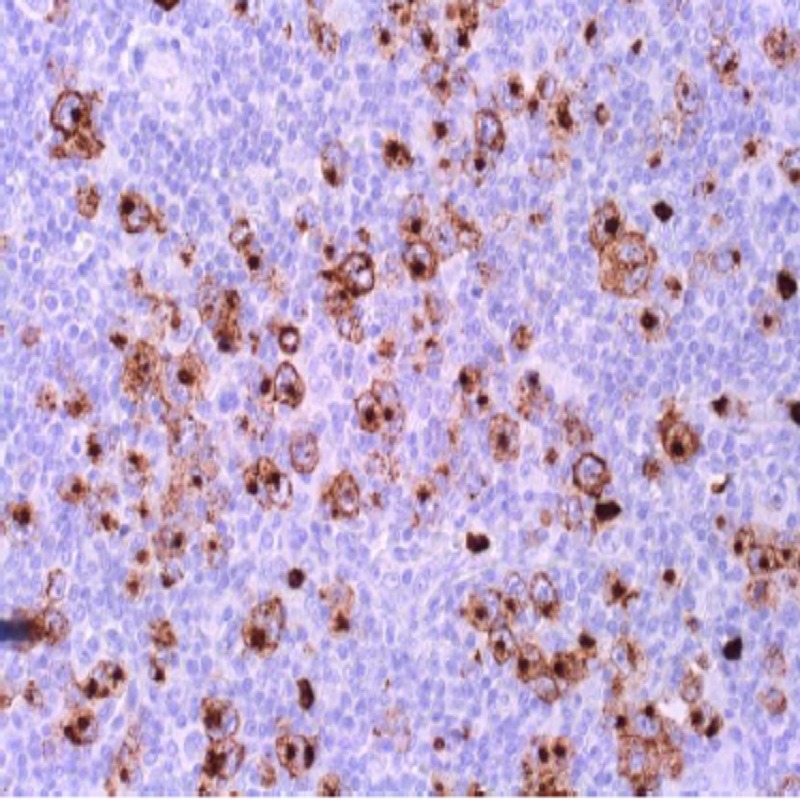 آنتی بادی CD15 برند NOVOCELL