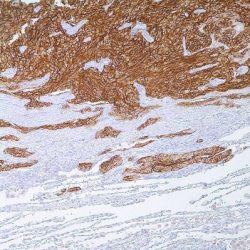 آنتی بادی CD56 برند NOVOCELL